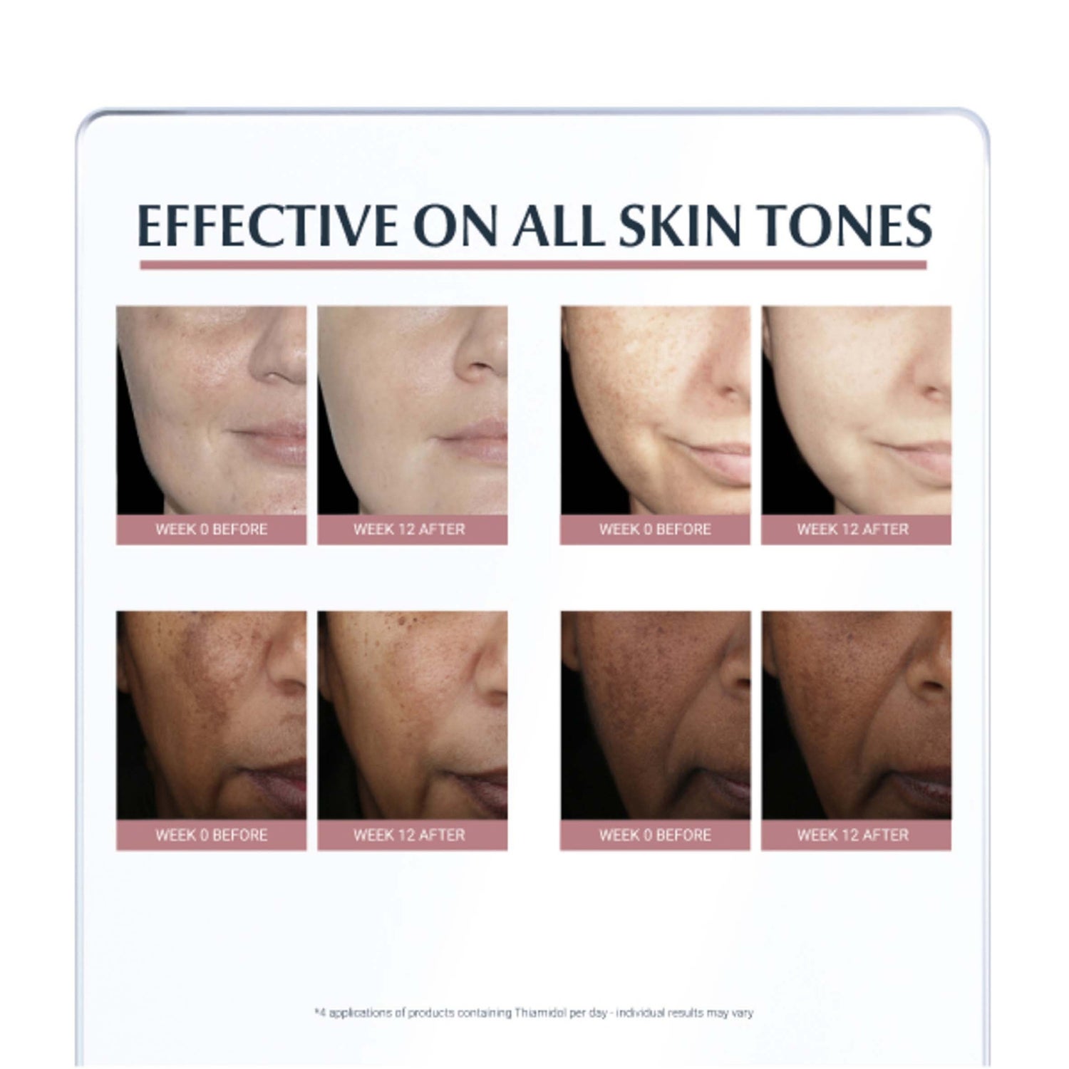 Eucerin Anti-Pigment