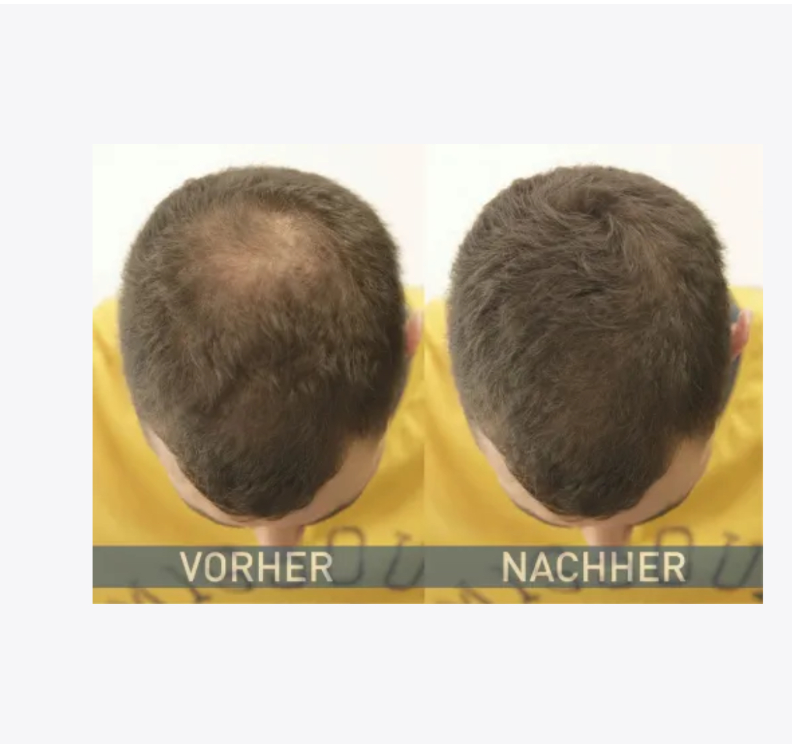 Streuhaar Haarverdichter Dunkelbraun, 14 g